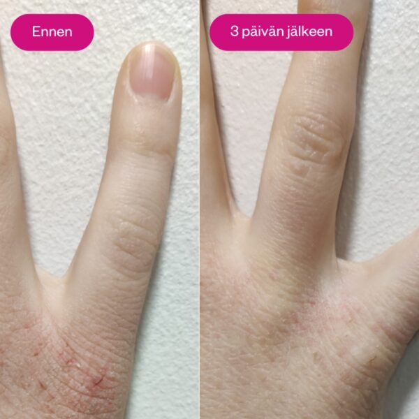 Flow Cosmetics Propolis & Probiotics Rescue Cream on täyteläinen erikoisvoide, joka rauhoittaa kuivuuden ja kiristyksen tunnetta sekä tukee ihon luonnollista suojamuuria.