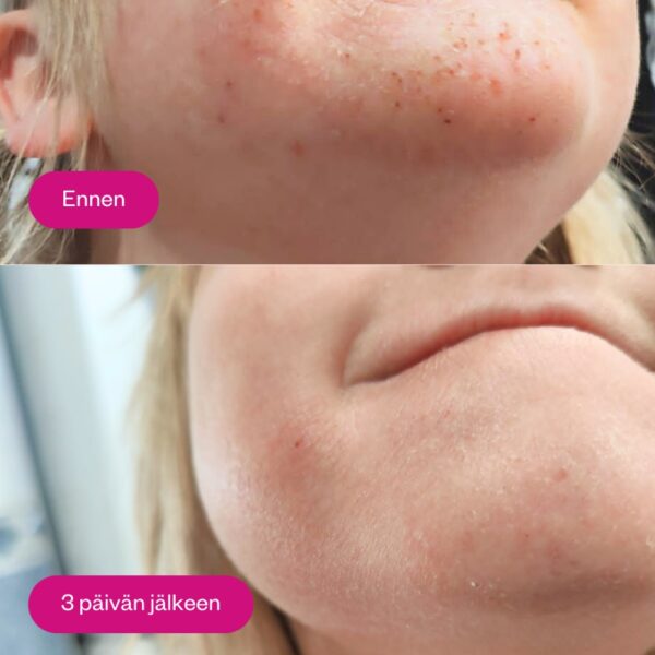 Flow Cosmetics Propolis & Probiotics Rescue Cream on täyteläinen erikoisvoide, joka rauhoittaa kuivuuden ja kiristyksen tunnetta sekä tukee ihon luonnollista suojamuuria.